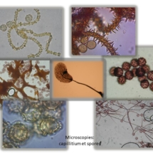24 Microscopie Capillitium et spores