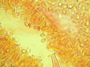 Pluteus cervinus, Plutée couleur de cerf, Pleurocytide et spores, ©Photo Gérard Rivet