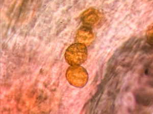 Spores Cortinarius sp. (Cortinaire), ©Photo Alain Millet
