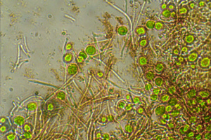 Hyphes du thalle et algues du genre Trebouxia dans lichen Parmelia saxatilis, ©Photo Alain Millet