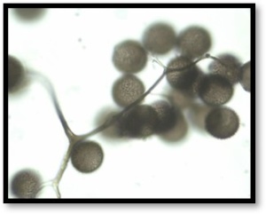 Amaurochaete comata, microscopie 1000x, Stemonitidaceae, ©Photo El Hacène Seraoui