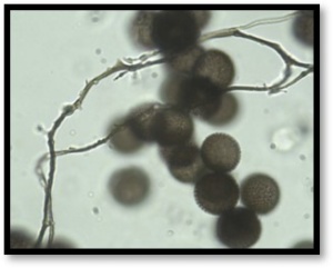 Amaurochaete comata, microscopie 1000x, Stemonitidaceae, ©Photo El Hacène Seraoui