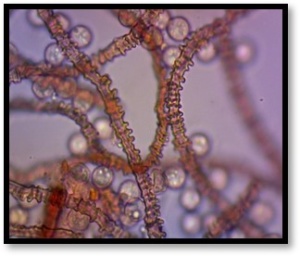 Arcyria helvetica, Arcyriaceae, microscopie 600x, ©Photo El Hacène Seraoui
