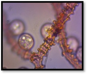 Arcyria helvetica, Arcyriaceae, microscopie 1000x, ©Photo El Hacène Seraoui