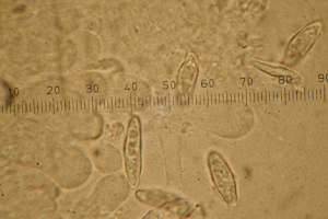 Spores de Lepiota ventriosospora, Bois de Sévrier en bas du Semnoz (74), ©Photo Alain Benard