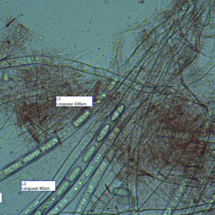Sarcoscypha coccinea (19/03/2020), Microscopie spores et asque, Pézize écarlate, Saint-Laurent (74), ©Photo Alain Benard