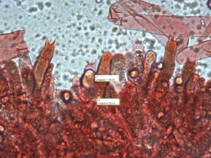 Baside (une spore encore accrochée à une baside à droite) et cystide (x400) d'Oudemansiella mucida, Collybie visqueuse, récoltée au Planet (Saint-Laurent, 74), ©Photo Alain Benard