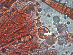 Spore (x1000) d'Oudemansiella mucida, Collybie visqueuse, récoltée au Planet (Saint-Laurent, 74), ©Photo Alain Benard