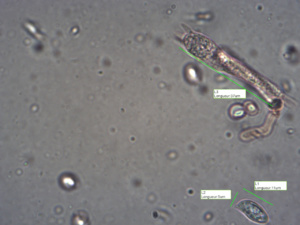 Spore et baside de Tricholoma pseudonictitans ; Tricholome brun et jaune, Tricholome fauve ; Pré Jourdan (Saint-Laurent, 74), ©Photo Alain Benard