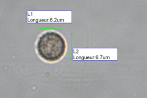 Tubifera ferruginosa, Tubifère ferrugineux, observation des spores finement crêtées-réticulées dans l'eau, taille hors ornementation, x1000