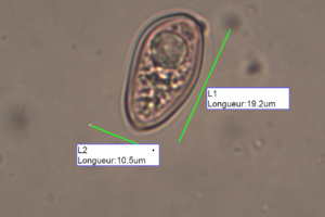 Spores de Macrolepiota mastoidea, Lépiote mamelonnée