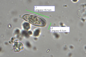 Spore (stries longitudinales présentes, pas évidentes à distinguer) de Xerocomellus pruinatus, Bolet pruineux, Leschaux (74), ©Photo Alain Benard