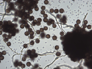 Microscopie de Diderma sp. ; Bois de la Touvière Leschaux ; ©Photo Alain Benard