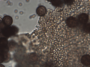 Microscopie du calcaire de Diderma sp. ; Bois de la Touvière Leschaux ; ©Photo Alain Benard