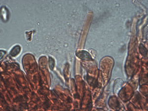 Cystide de Clitopilus cystidiatus ; Meunier gris ; Saint-Jorioz, Entredozon (74) ; ©Photo Alain Benard