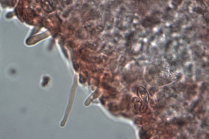 Cystides de Clitopilus cystidiatus ; Meunier gris ; Fillière, La Sapinière (74) ; ©Photo Alain Benard