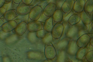 Chlamydospores de Asterophora parasitica (x1000 à sec), Nyctalis parasite, Col de Ludran (Viuz-en-Sallaz, 74)