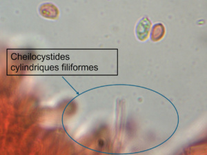 Cheilocystides (x1000) de Clitopilus geminus ; Rhodocybe tronqué ; Saint-Laurent, Planet (74) ; ©Photo Alain Benard