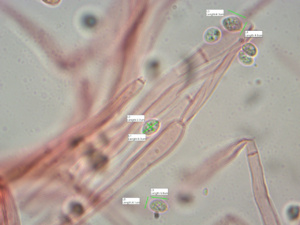 Spores (x1000) de Clitopilus geminus ; Rhodocybe tronqué ; Saint-Laurent, Planet (74) ; ©Photo Alain Benard